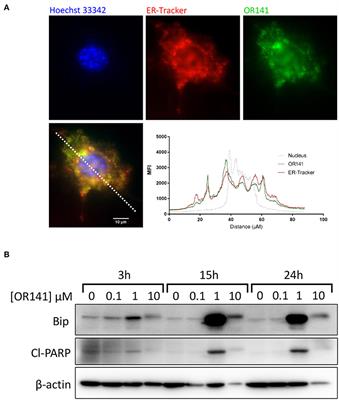 Low Photosensitizer Dose and Early Radiotherapy Enhance Antitumor Immune Response of Photodynamic Therapy-Based Dendritic Cell Vaccination